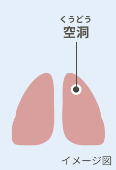 空洞(くうどう)イメージ図