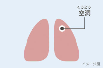 空洞(くうどう)イメージ図